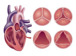 Best Aortic Surgeon in Marine Lines